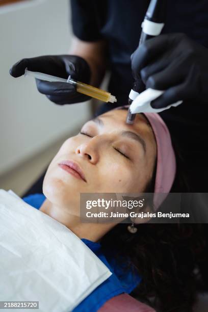 esteticista aplicando plasma rico en plaquetas con dermapen en la frente del paciente - plasma rico en plaquetas fotografías e imágenes de stock