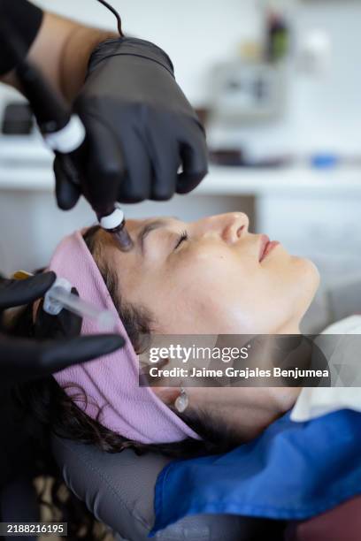 esteticista aplicando plasma rico en plaquetas con dermapen durante el tratamiento facial - plasma rico en plaquetas fotografías e imágenes de stock