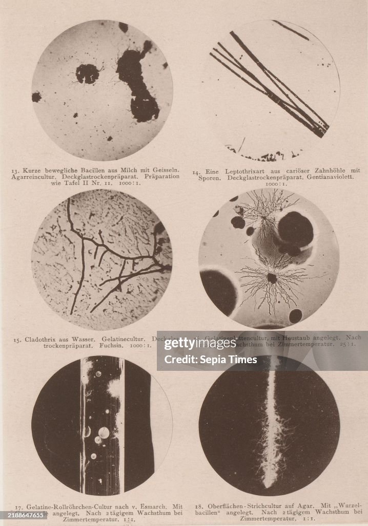 Six microscope images of bacteria