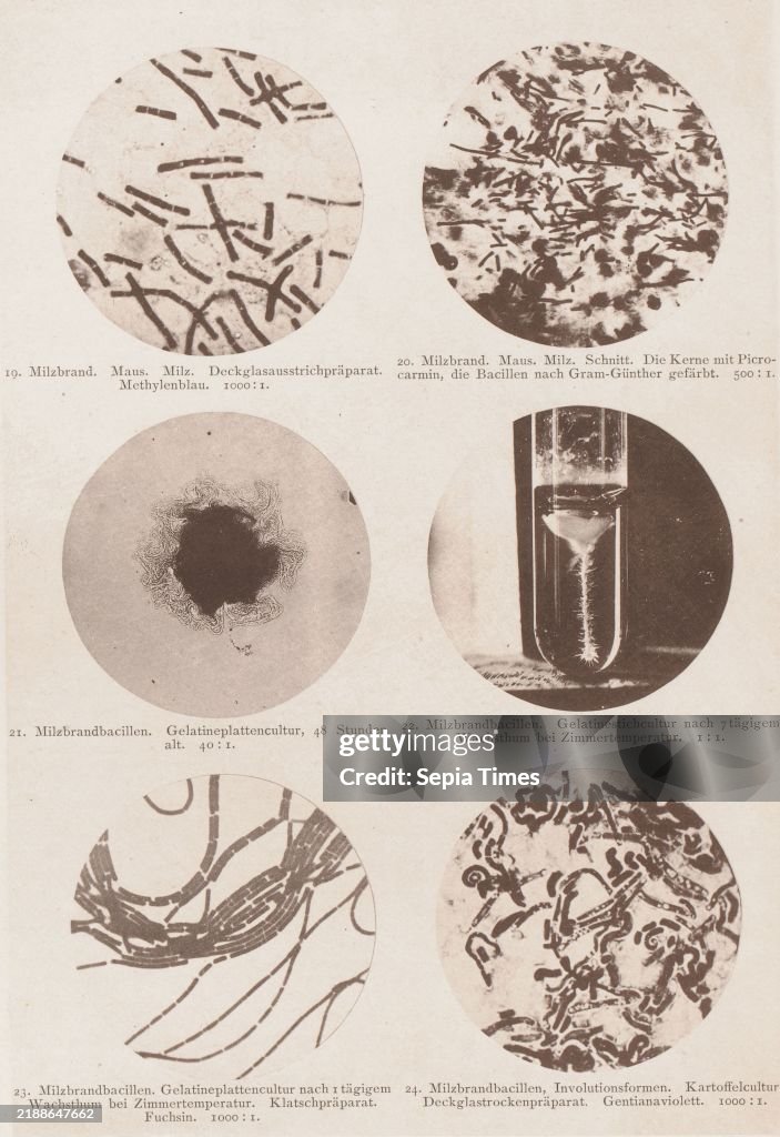 Six microscope images of the anthrax bacterium