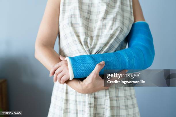 close-up of cast broken arm of a woman - bone fracture stock pictures, royalty-free photos & images