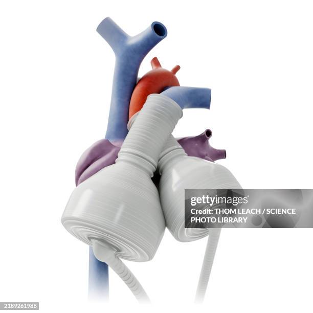 artificial heart structure, illustration - artificial heart stock illustrations