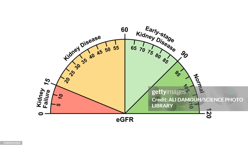 Kidney Output Numbers Creatinine Levels And Kidney Disease Illustration High-Res Vector ...
