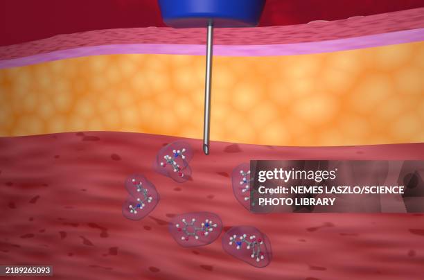 Endocrine Injection 3,513 Endocrine Gland Stock Photos, High-Res Pictures, and Images ...