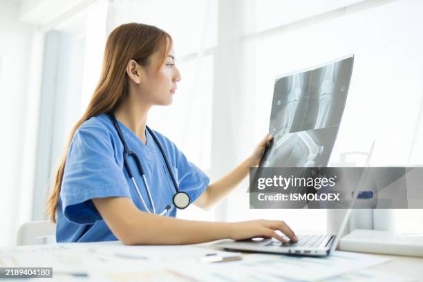 asian female doctor looking at an x-ray of a knee - bone cancer color photos et images de collection