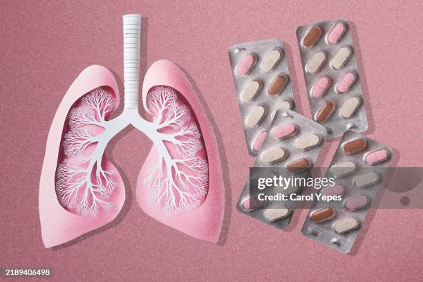 lungsand pills - transplant surgery stock pictures, royalty-free photos & images