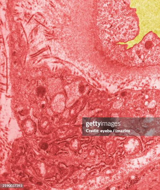 Capillary Microscope Views 128 Micrograph Capillary Stock Photos, High-Res Pictures, and Images ...