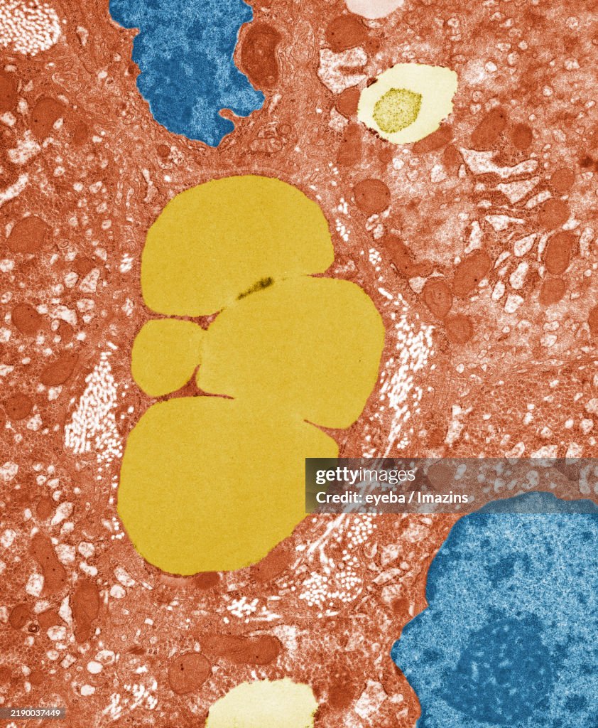Ito cells, fat-containing cells, vitamin A storage. Photographed using a transmission electron microscope