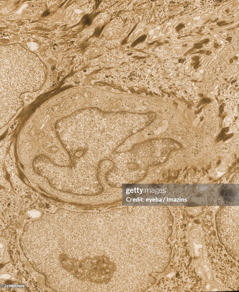Photograph taken with a transmission electron microscope of a Langerhans cell