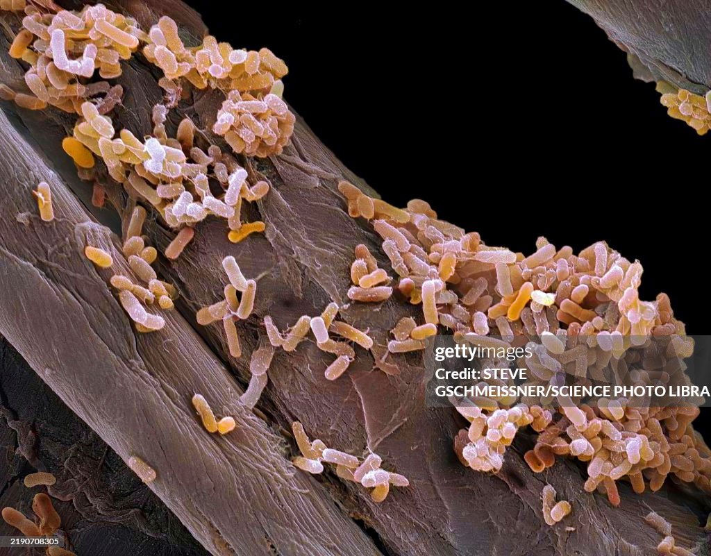 Salmonella bacteria, SEM