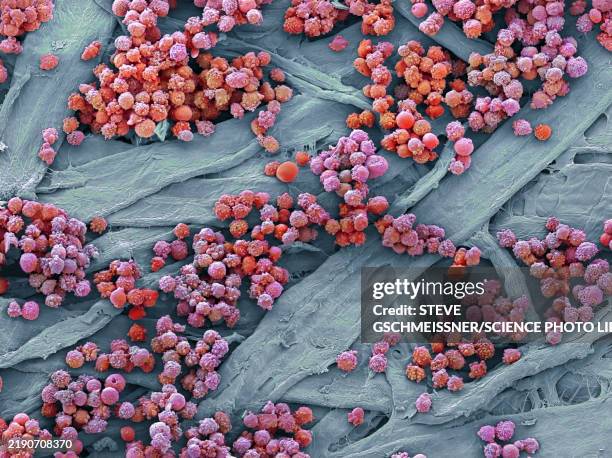 leukaemia, sem - rasterelektronenmikroskop stock-fotos und bilder