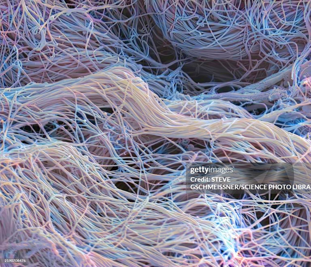 Connective tissue, SEM