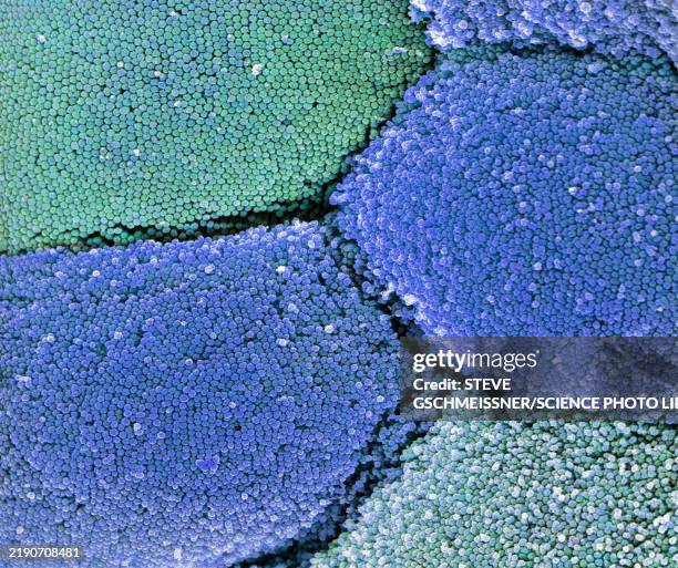 intestinal microvilli, sem - epitelio fotografías e imágenes de stock