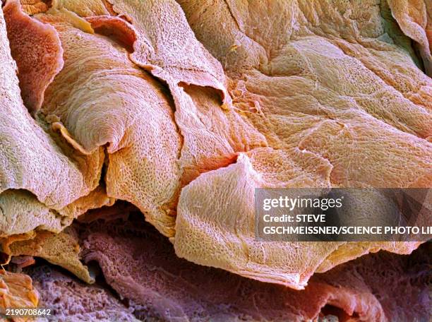 wound scab, sem - micrografia eletrónica de varrimento imagens e fotografias de stock