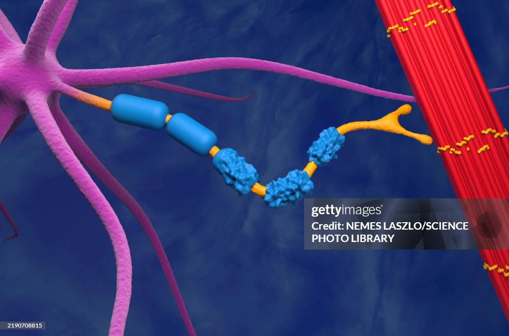 Neuromuscular junction in amyotrophic lateral sclerosis, illustration