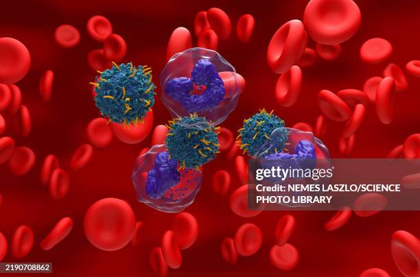 car-t cell therapy for chronic myeloid leukaemia, illustration - turner syndrome stock illustrations