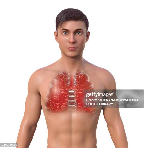 lung miliary tuberculosis, illustration - upper respiratory stock illustrations
