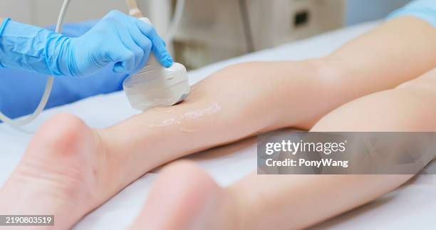 ecografia per lesioni al polpaccio di giovane femmina - gamba umana foto e immagini stock