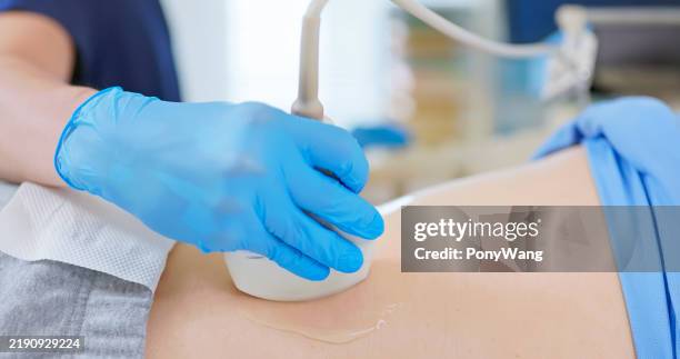 elder receive kidney ultrasound - nierbekkenontsteking stockfoto's en -beelden