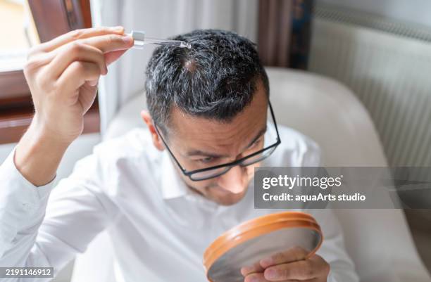 liquid dropper therapy on scalp lipoma - sebaceous cyst stock pictures, royalty-free photos & images