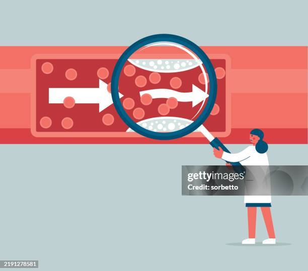 blood vessel - atherosklerose stock-grafiken, -clipart, -cartoons und -symbole