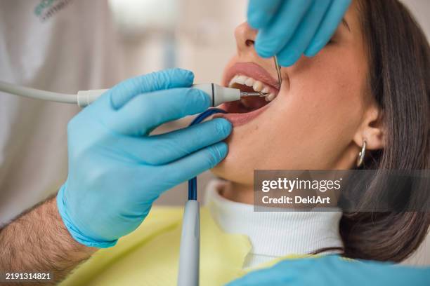 el dentista elimina el cálculo dental del paciente en el consultorio dental - dientes humanos fotografías e imágenes de stock