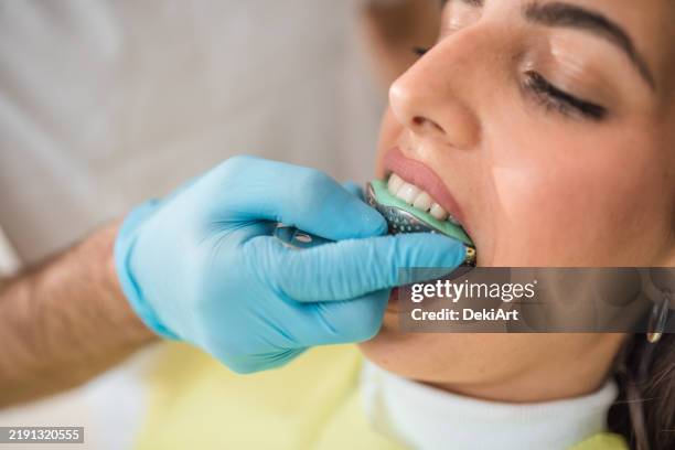 woman patient undergoing dental treatment, taking an impression for dentures - dental mould stock pictures, royalty-free photos & images