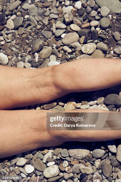 old woman legs with varicose veins on the pebble beach. - varicose vein stock pictures, royalty-free photos & images