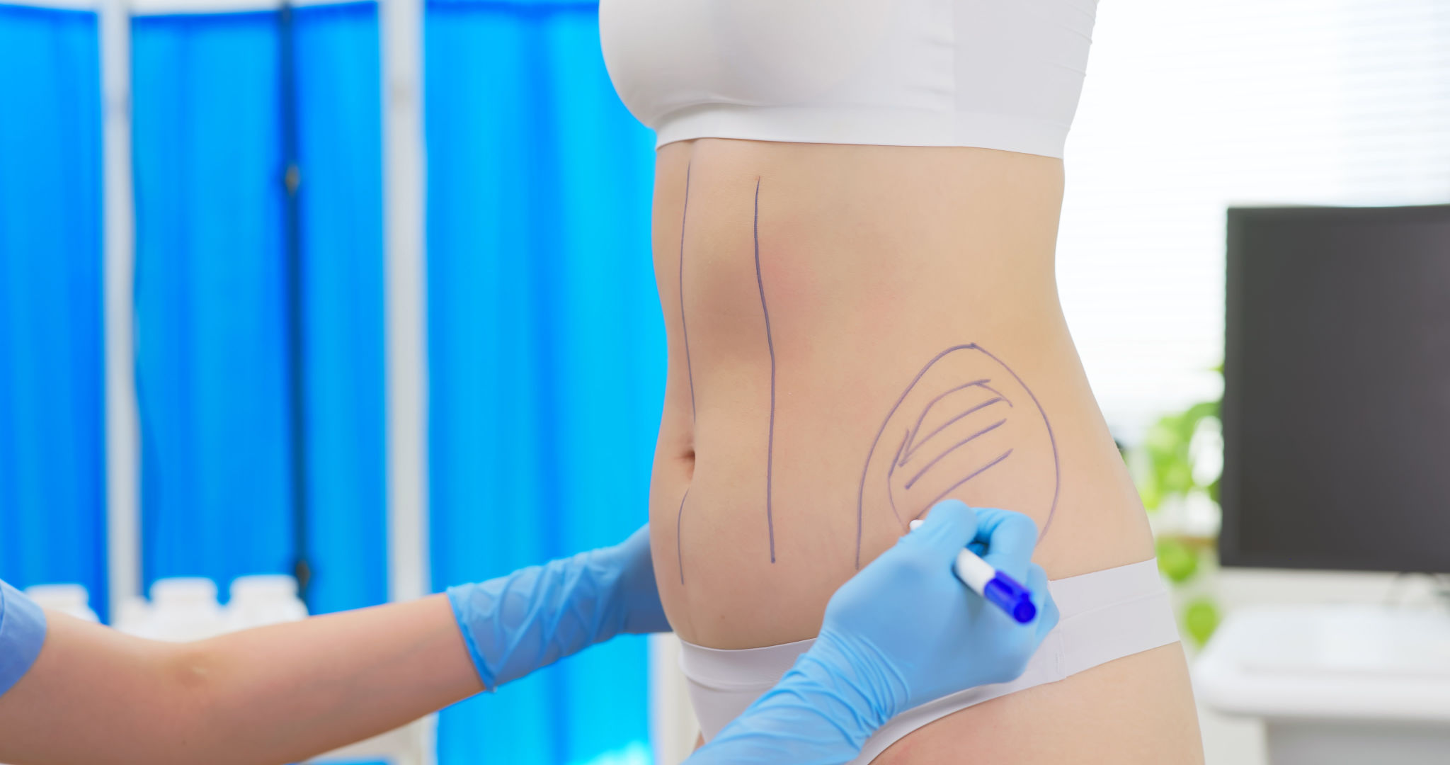 body contour surgery