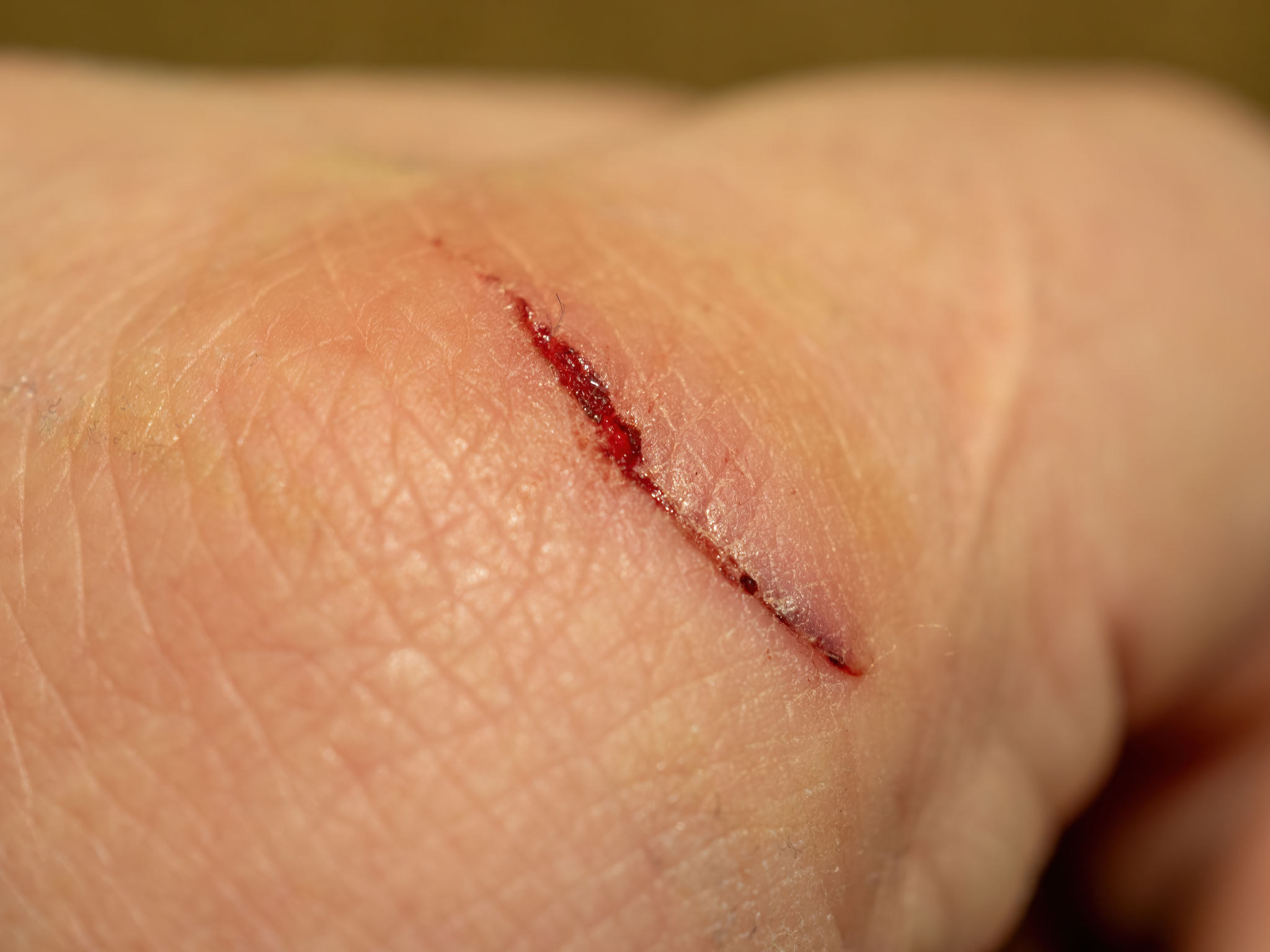 bleed margins