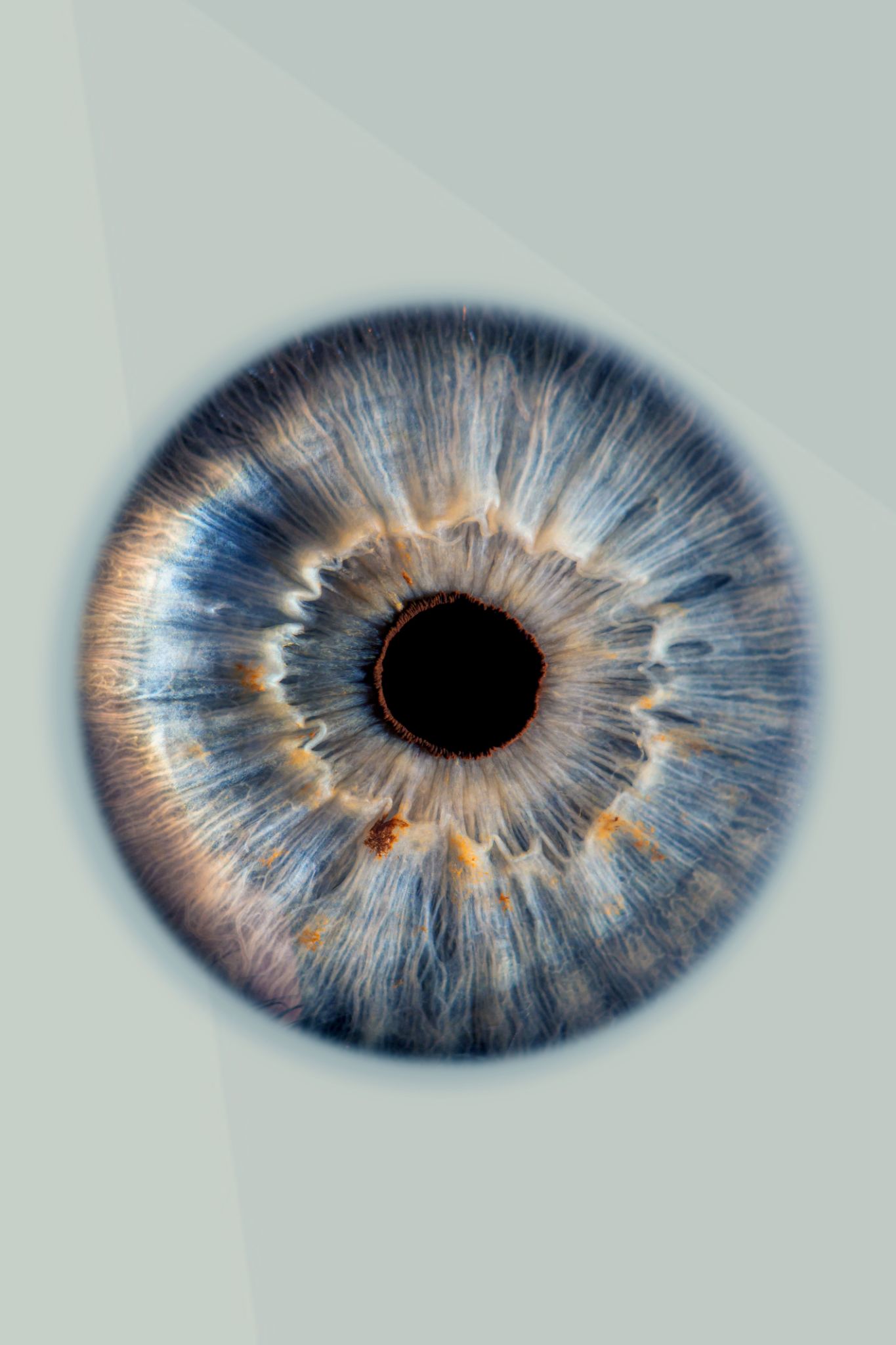 iridologia occhio
