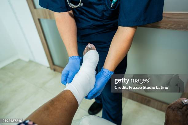 nahaufnahme eines arztes, der einen orthopädischen gips auf einer arztpraxis anlegt - menschliches gelenk stock-fotos und bilder