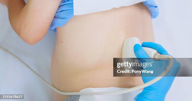 elder receive kidney ultrasound - nierbekkenontsteking stockfoto's en -beelden
