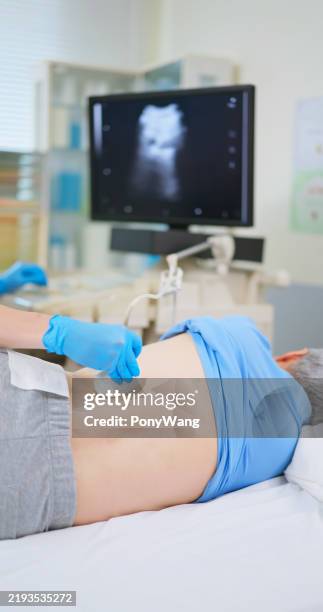 elder receive kidney ultrasound - nierbekkenontsteking stockfoto's en -beelden