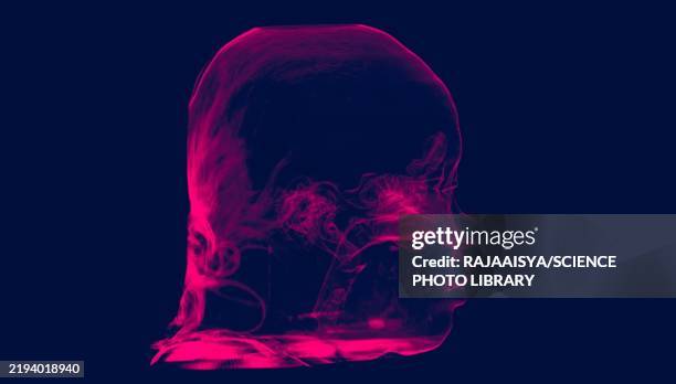 upper airways, 3d ct scan - nasopharynx stock pictures, royalty-free photos & images