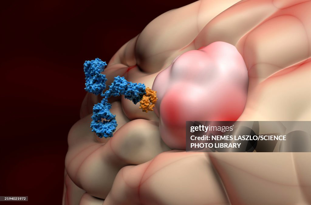 Monoclonal antibody therapy for meningioma, illustration
