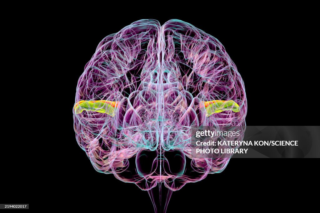 Transverse temporal gyri, illustration