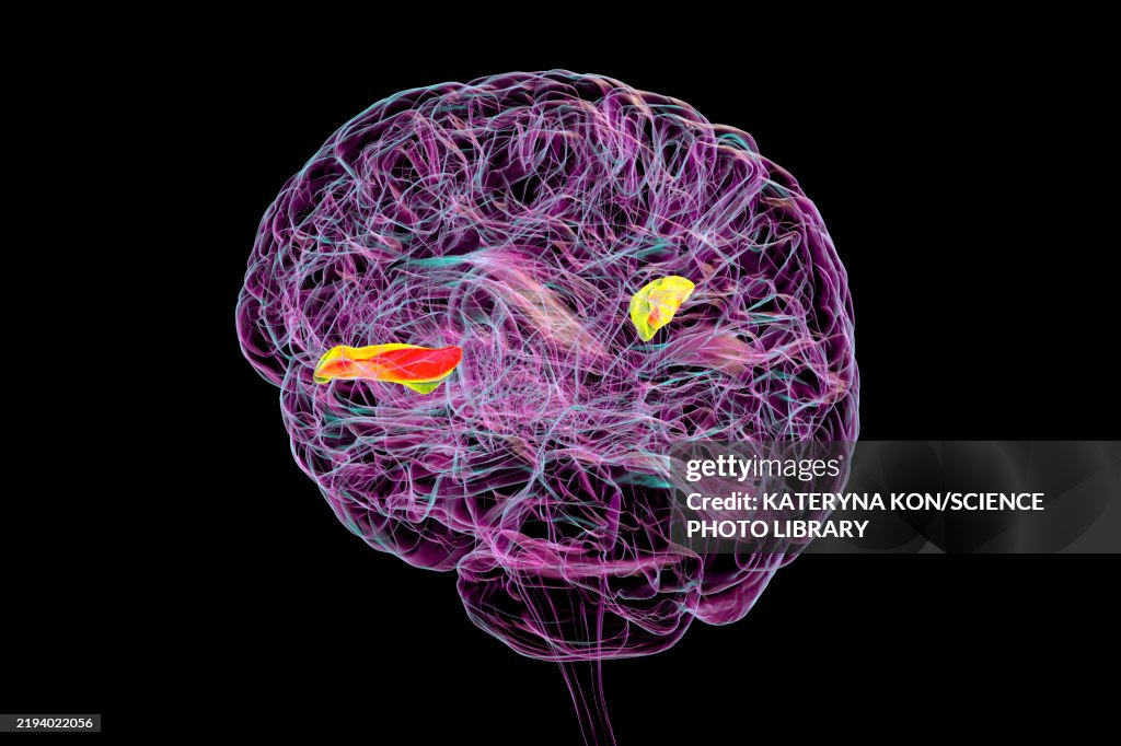 Gyri Simple Transverse Temporal Gyri Illustration High-Res Vector Graphic - Getty ...