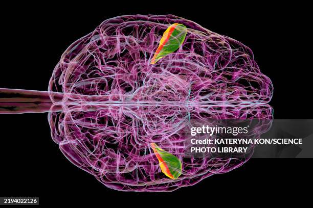 transverse temporal gyri, illustration - language processing stock illustrations