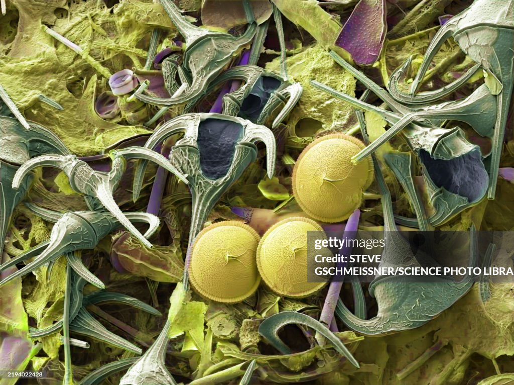 Plankton, SEM
