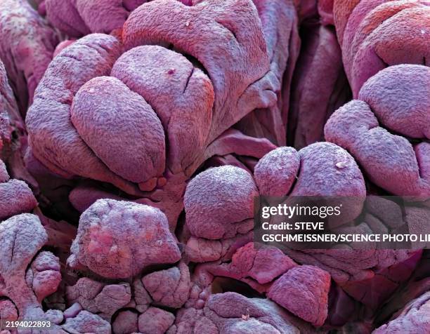 fallopian tube, sem - secretory cell stock pictures, royalty-free photos & images