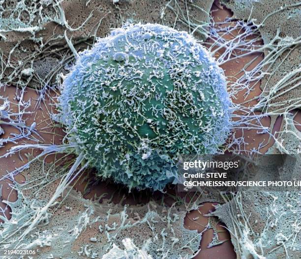 hela cell, sem - microscopia eletrônica de varredura - fotografias e filmes do acervo