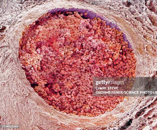 artery, sem - sem stock pictures, royalty-free photos & images