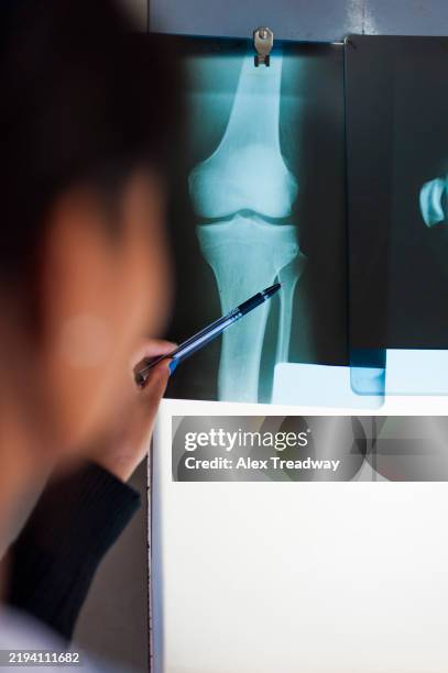 x-ray - xray light box stock pictures, royalty-free photos & images