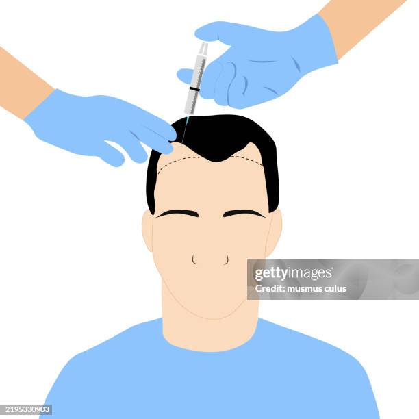 hair transplant illustration - beard grooming stock illustrations