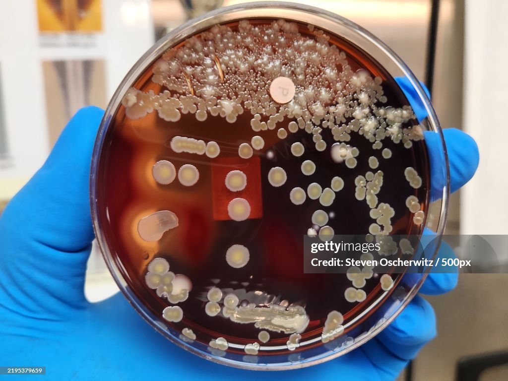 Acinetobacter antibiotic resistant bacterial colonies on agar plate