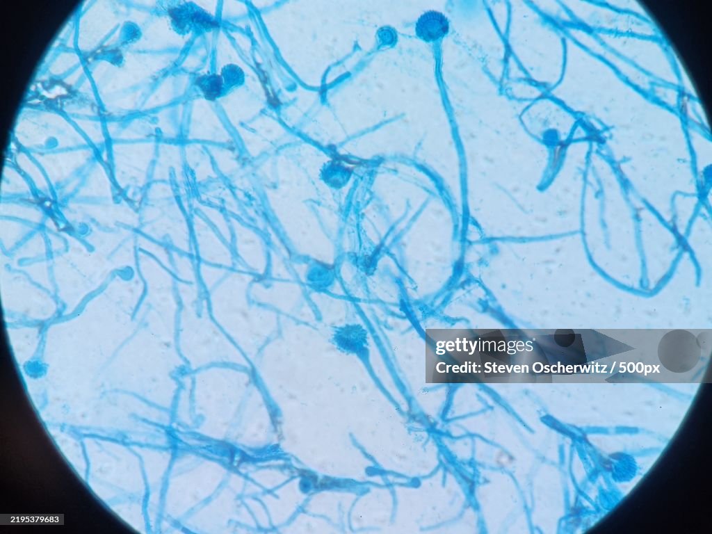 Aspergillus conidiophores stained with lactophenol cotton blue