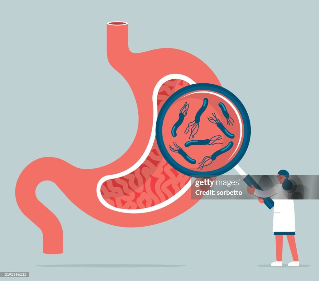 Human stomach infected Helicobacter Pilori