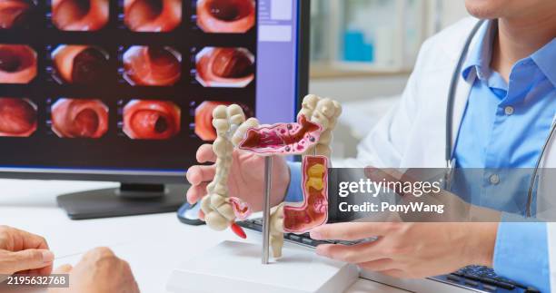 el médico explica el examen de colonoscopia - sistema-digestivo-humano fotografías e imágenes de stock