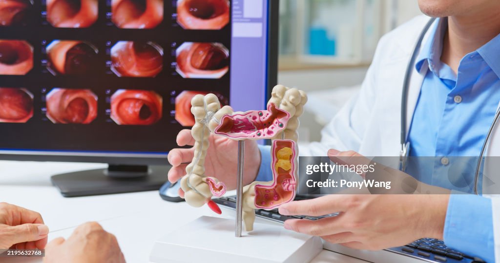 Doctor explain colonoscopy exam